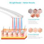 XPREEN XPRE052 Wireless Rechargeable Light Acne Treatment Device Home Acne Clearing Eraser with Blue Light and Red Light(White) - British D'sire