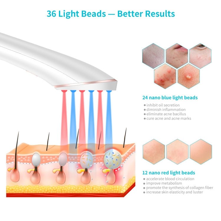 XPREEN XPRE052 Wireless Rechargeable Light Acne Treatment Device Home Acne Clearing Eraser with Blue Light and Red Light(White) - British D'sire