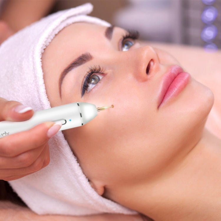 Xpreen XPRE061 Professional Dark Spot Remover Freckle Tattoo Chargeable Wart Mole Remover, with LED Screen and Spotlight(Tarnish) - British D'sire