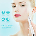 Xpreen XPRE061 Professional Dark Spot Remover Freckle Tattoo Chargeable Wart Mole Remover, with LED Screen and Spotlight(Tarnish) - British D'sire