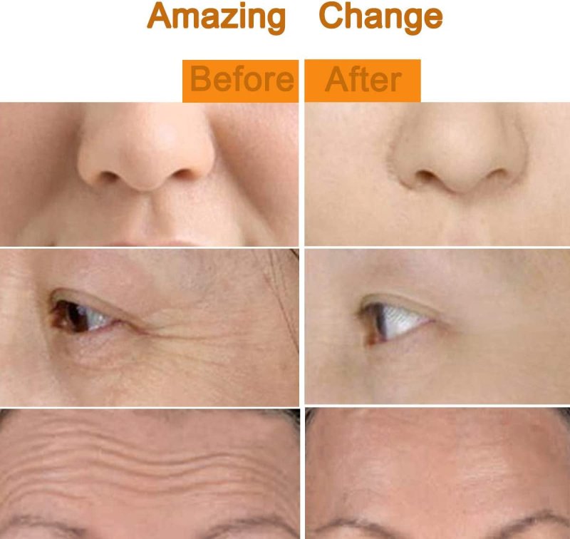 2 in 1 Face Massager Roller Gold Facial Massager, Electric 3D Face Roller and T Shape Arm Eye Nose Head Massager Instant Face Lift anti Wrinkles - Skin Care Kits & Combos - British D'sire