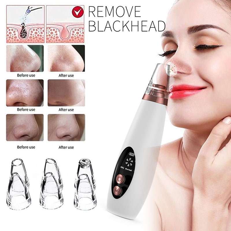 Blackhead Remover Pore Vacuum Cleaner - Upgraded Blackhead Suction Tool With Display-USB Rechargeable Facial Pore Cleanser 6 Replaceable Suction Probes For All Skin - Face Care - British D'sire