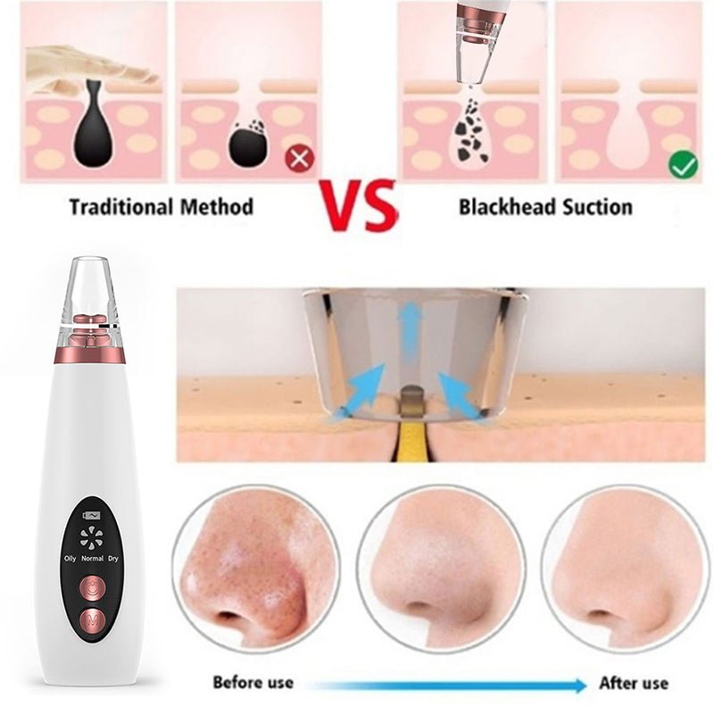 Blackhead Remover Pore Vacuum Cleaner - Upgraded Blackhead Suction Tool With Display-USB Rechargeable Facial Pore Cleanser 6 Replaceable Suction Probes For All Skin - Face Care - British D'sire