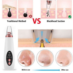 Blackhead Remover Pore Vacuum Cleaner - Upgraded Blackhead Suction Tool With Display-USB Rechargeable Facial Pore Cleanser 6 Replaceable Suction Probes For All Skin - Face Care - British D'sire