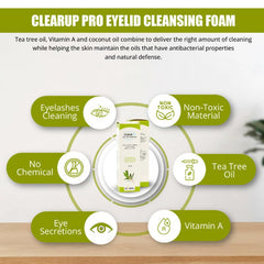 KIVEMA Foaming Eyelid Wash - Specially Formulated - Eyelid Cleanser for Irritated Eyes - Eyes Care - British D'sire